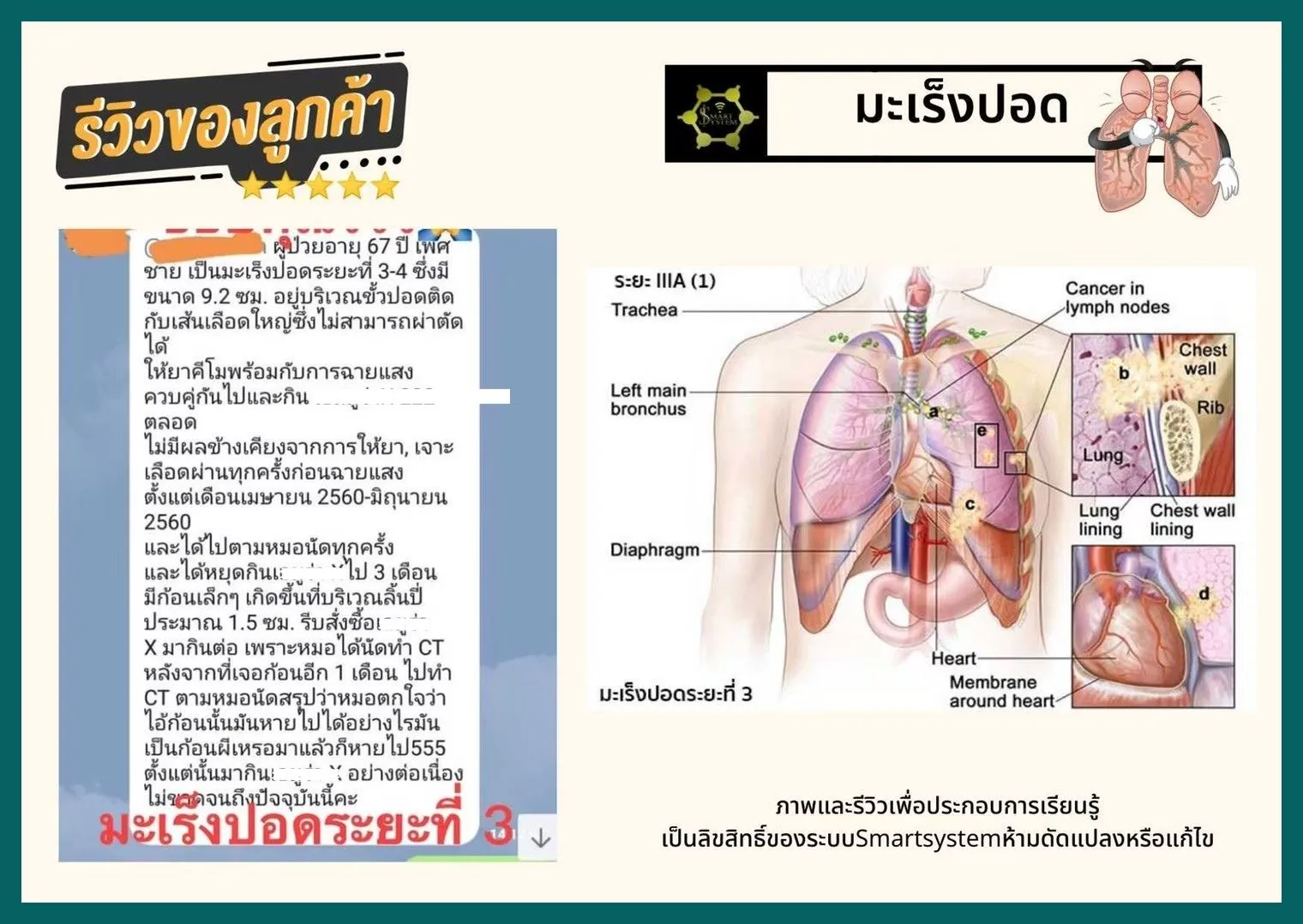 เซซามิน มะเร็ง